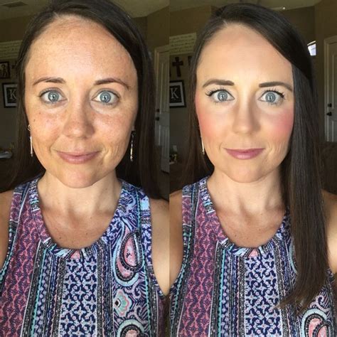 Before and after using #LimeLightByAlcone. | All natural skin care ...