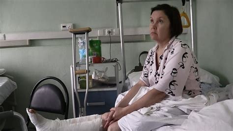 Москвичке сломали обе ноги в давке в метро
