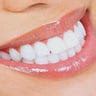 teeth whitening medium