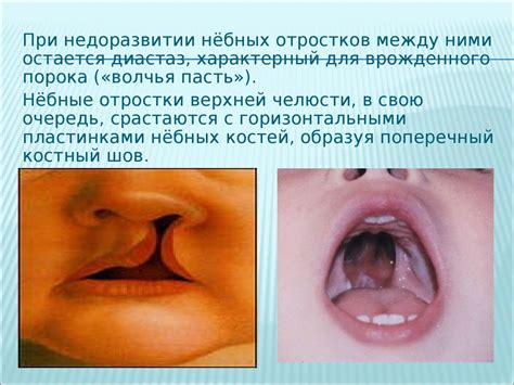 Топографическая анатомия полости рта - презентация онлайн