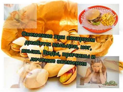 Онемение при сахарном диабете: пальцев, ног, языка. Виды, причины и ...