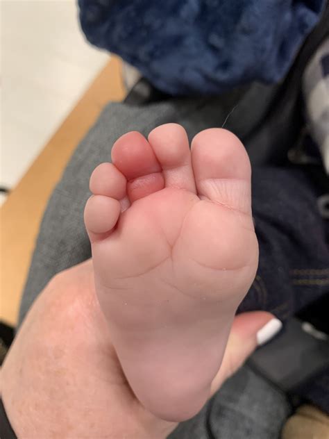 My baby nearly lost his toe after hair wrapped around it – my warning