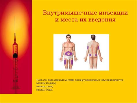 Виды инъекций