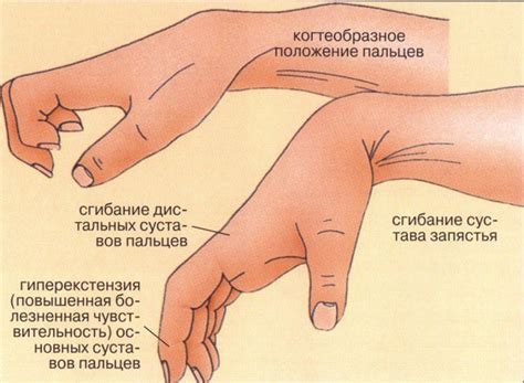 Методы лечения пассивной и активной контрактуры суставов