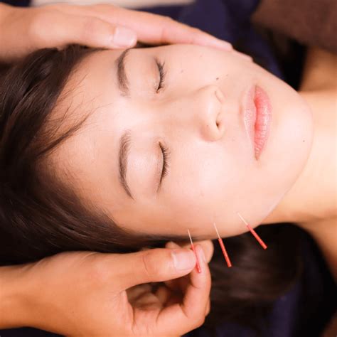 Facial Rejuvenation Acupuncture | Urban Wellness Toronto