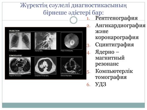 Жүрек қарыншалары мен жүрекшелері гипертрофиясының визуальді ...