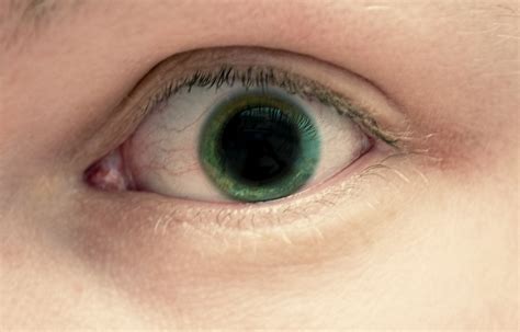 Miosis Y Midriasis