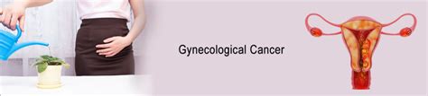 Best Gynecological Cancer Treatment in Hyderabad | Dr Sachin Marda ...