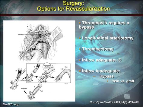 PPT - Acute Mesenteric Ischemia PowerPoint Presentation, free download - ID:520336