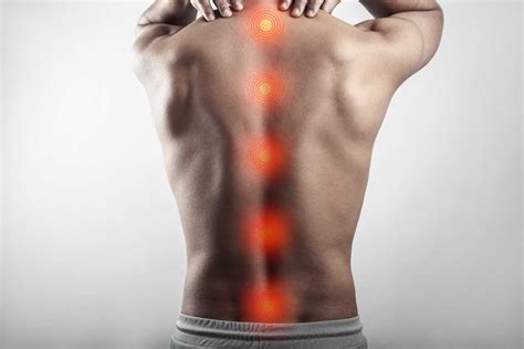 Myths and Misconceptions About Spinal Cord Injuries