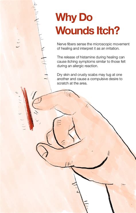Why Do Wounds Itch? Healing Process and How to Accelerate It Naturally
