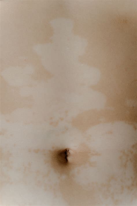 How to clean a belly button - Yoors