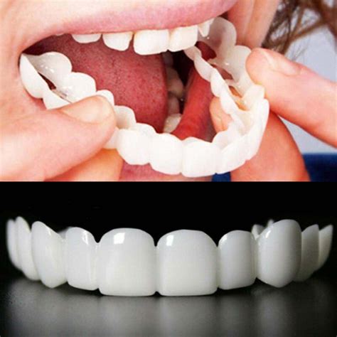Snapklik.com : Renyqatt Tooth Repair Kit Moldable False Teeth DIY