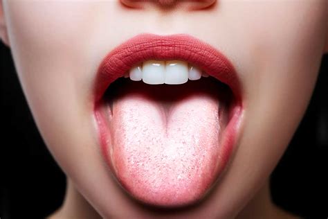9 Remèdes de Grand-mère pour traiter la Langue Blanche : Guide complet ...