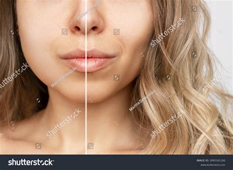 dimple face images stock  vectors shutterstock
