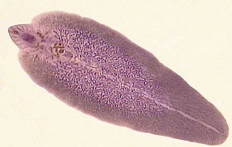 Trematoda; Flukes