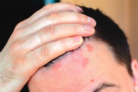 7 Rare Skin Diseases