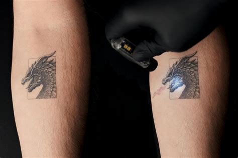 Magic Ink: How "Rewritable" Tattoos Will Change Tattooing Forever