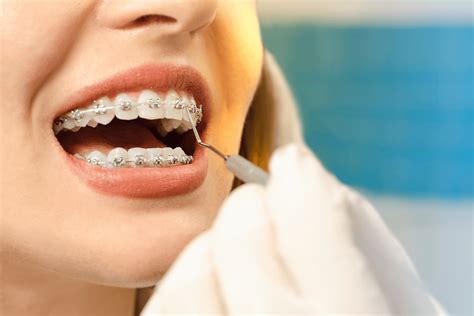 Can Braces Change Your Face Shape? | Roseacre Dental