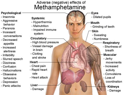 Enlarged Liver Symptoms Liver Pain | MedicineBTG.com