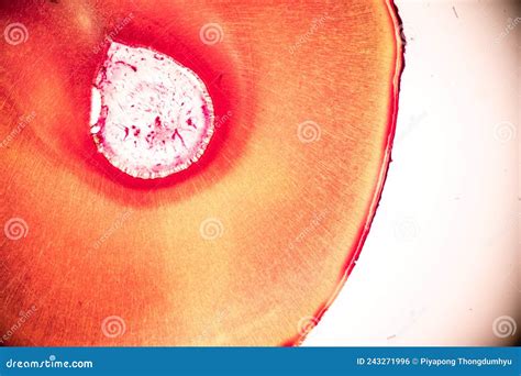tooth development  human  microscope stock photo image
