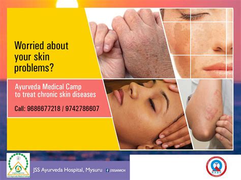 Ayurveda Medical Camp To Treat Chronic Skin Diseases - JSS Ayurveda Hospital, Mysuru