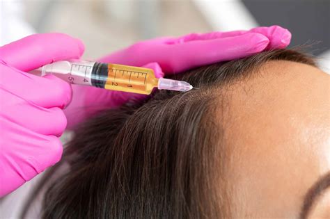 PRP Injections for Hair Loss: A Comprehensive Guide - H-Shot