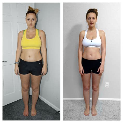 Dairy Free Diet Before And After Acne