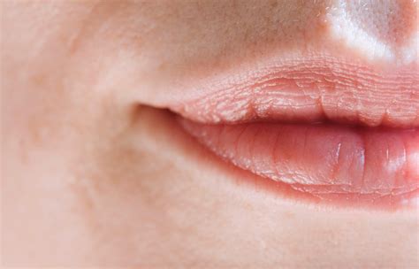 Treatment of lip contour irritation: causes, care and effective solutions