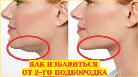 Как убрать второй подбородок за 10 минут - YouTube