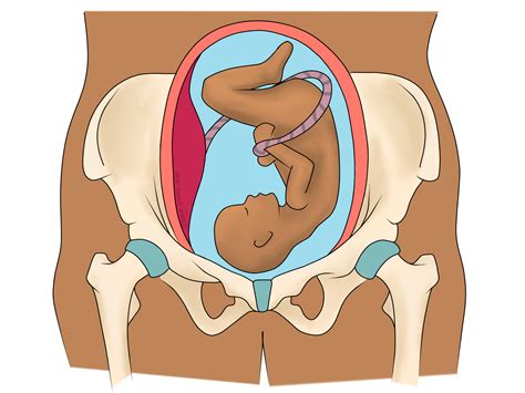 SPD and PGP: Pelvis Pain in Pregnancy - Beverley Palmer Osteopath Dubai