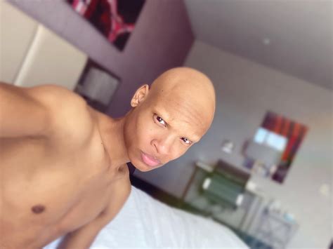 Norman Freeman - #loveyouguys #alopeciaawarness... | Facebook