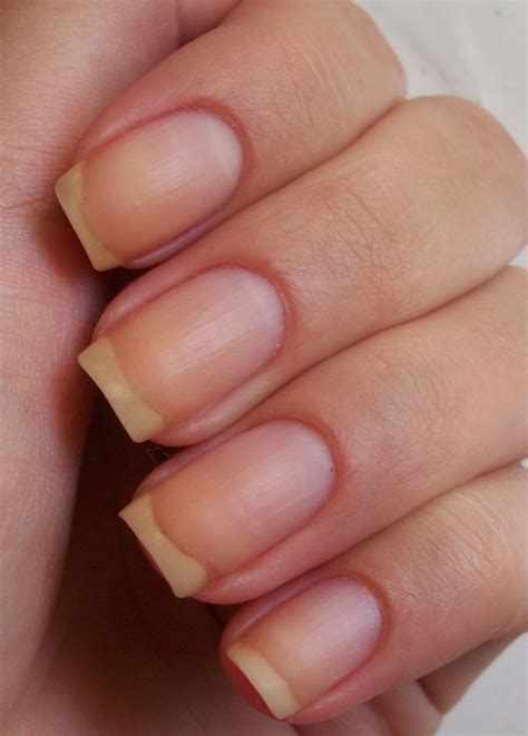 Сommunity Nail Polish Mania - Сообщество Лакомания: Гель для удаления ...