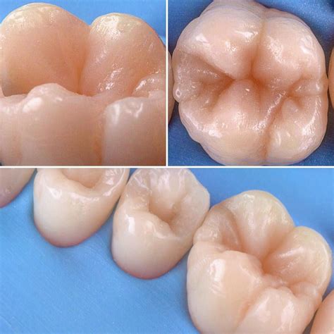 1,798 Likes, 13 Comments - All Dental / Вся Стоматология (@alldental ...