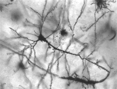 Dendritic Spines and Memory | Medical Science Navigator