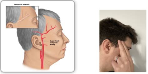 osce peripheral pulses flashcards quizlet