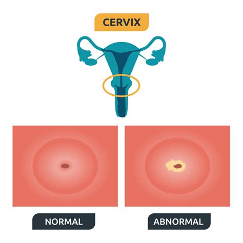 Cervix 548283 Vector Art at Vecteezy