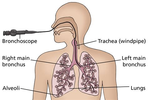 bronchoscopy leeds teaching hospitals nhs trust