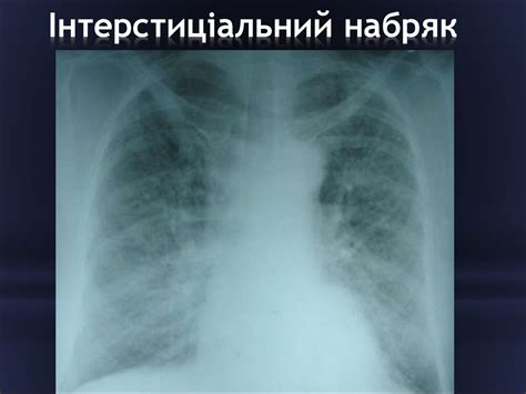 Променева діагностика невідкладних станів - презентация онлайн