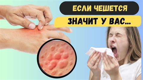 Почему чешется тело? И от чего вы чихаете? Это симптом… - YouTube