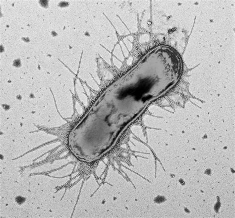 Что такое E. coli и как его лечить