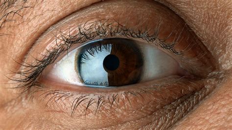 Macular Degeneration (AMD) Overview | Christ Memorial