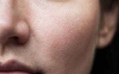 What Skin Type Do You Have? There are four types.