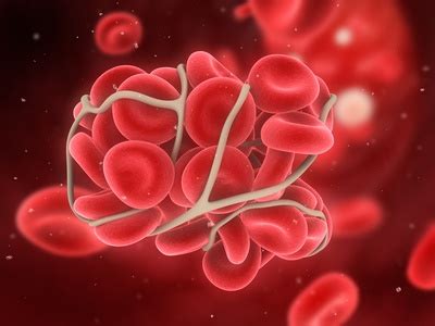 Phlébite : symptômes, traitement, définition - docteurclic.com