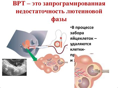 Гестагенная поддержка в циклах ВРТ и первом триместре беременности ...