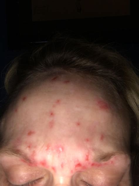 Why Am I Picking At My Skin at Sophie Peters blog