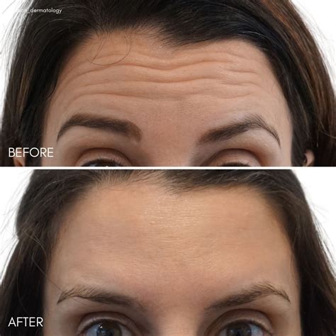 Mclean dermatology and skincare dermatologist dr lily talakoub – Artofit