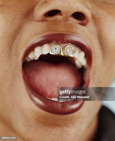 open teeth stock  high res pictures  images getty images