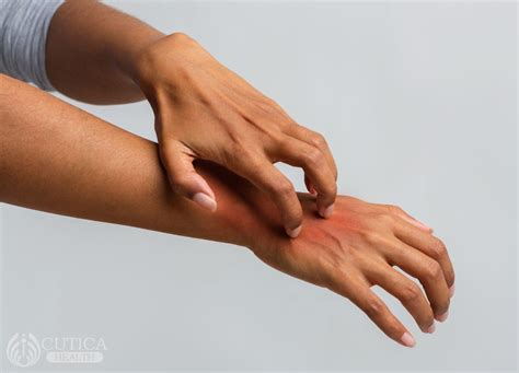 What to Know about Psoriatic arthritis - Octosoft Website