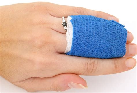 closed wounds klarity health library